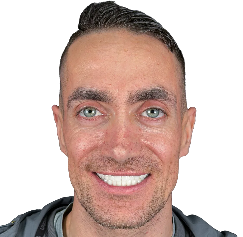 Invisalign - Sonrası
